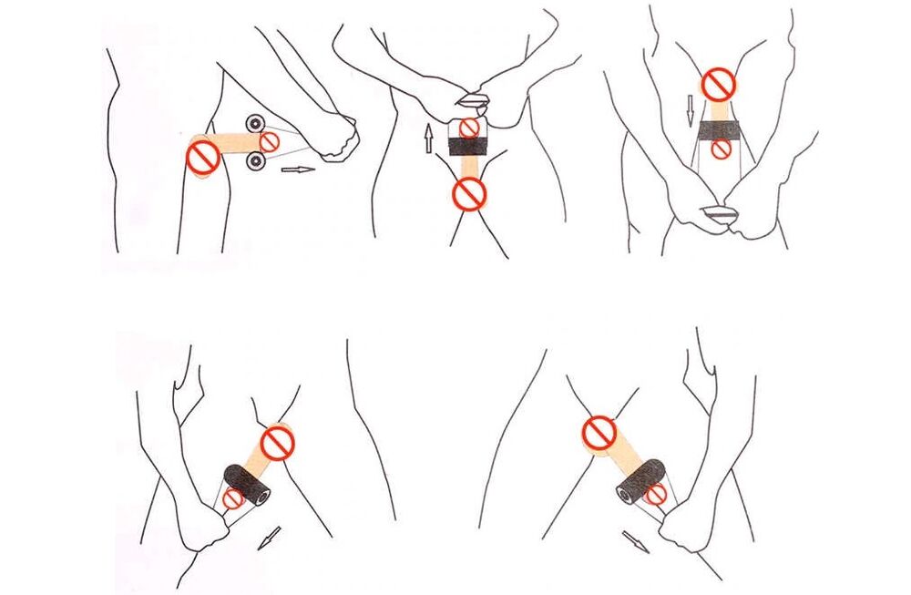 jelqing a pénisz bővítésére